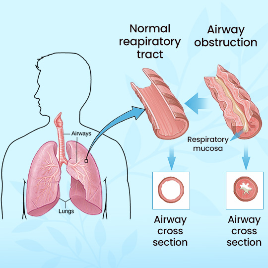 Ximonth | Smooth breathing, new breathing experience!